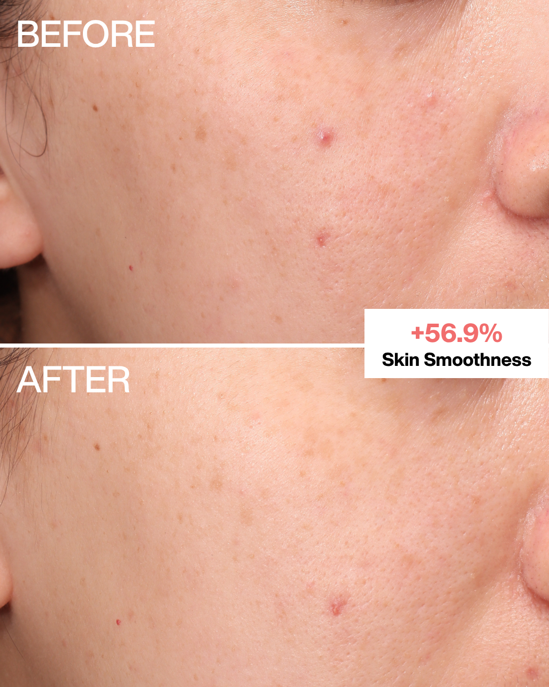 Generative Face & Neck Serum
